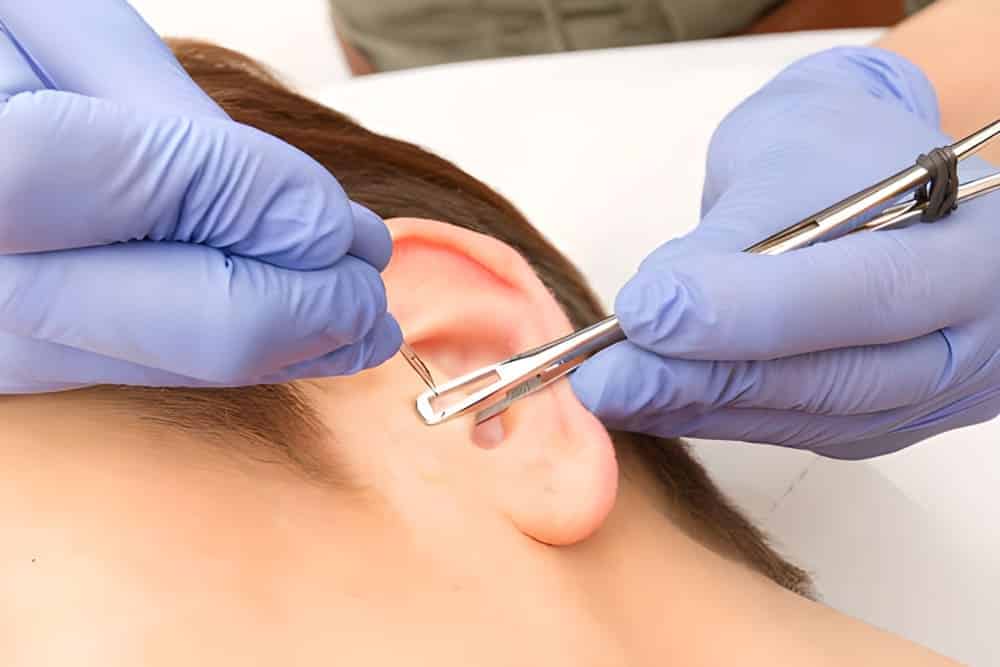 ¿Piercing daith como remedio contra las migrañas?